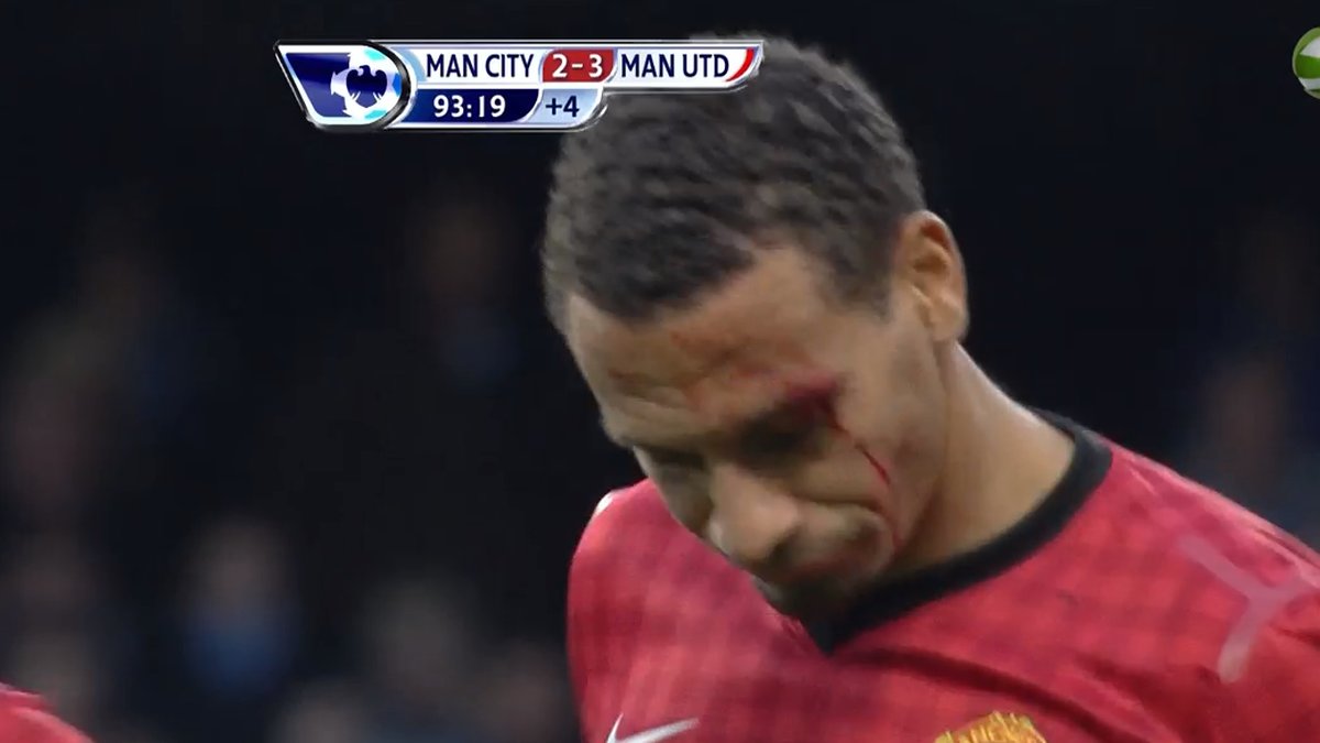 Rio Ferdinand blödde kraftigt efter City-fansen attack.
